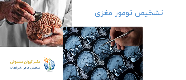 روش های تشخیص تومور مغزی 