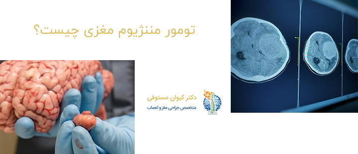 تومور مننژیوم مغزی چیست؟