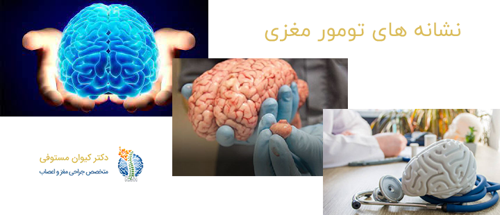 درباره نشانه های تومور مغزی