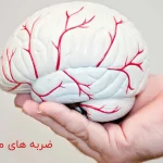 هر انچه درباره ضربه مغزی باید بدانید