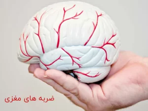هر انچه درباره ضربه مغزی باید بدانید