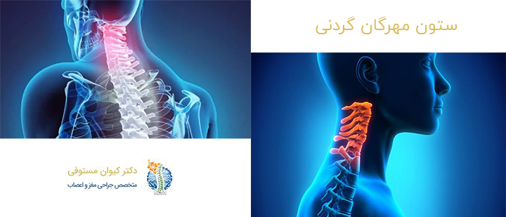 ستون مهرگان گردنی