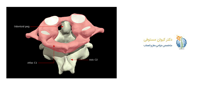 مهره های گردنی