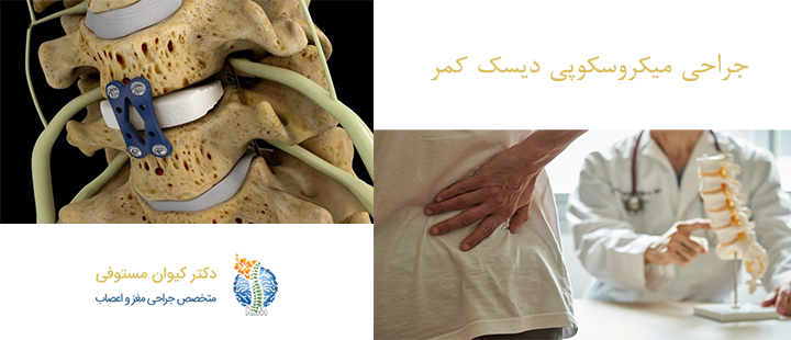جراحی میکروسکوپی دیسک کمر 