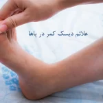 علائم دیسک کمر در پاها