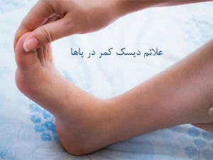 علائم دیسک کمر در پاها