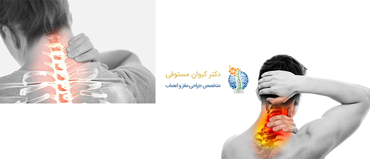 درباره دیسک گردن
