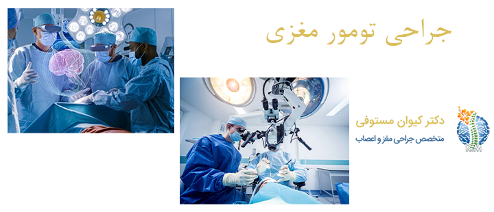 درباره جراحی تومور مغزی 