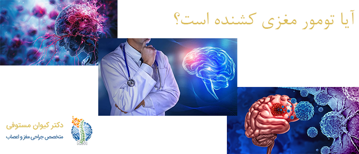 آیا تومور مغزی کشنده است؟