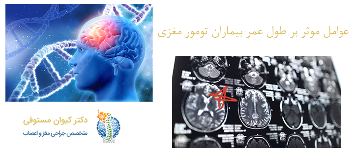 عوامل موثر بر طول عمر بیماران تومور مغزی