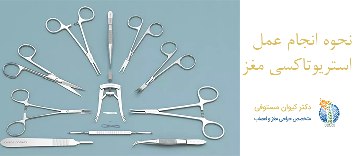 نحوه انجام  استریوتاکسی مغز
