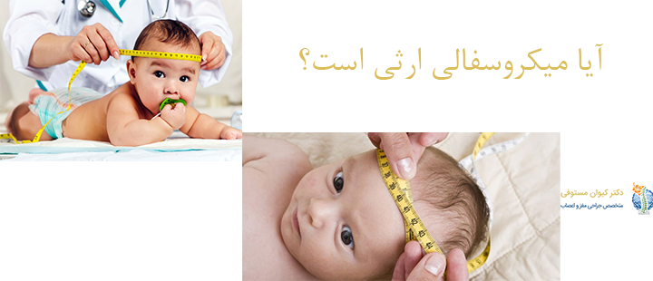 آیا میکروسفالی ارثی است؟