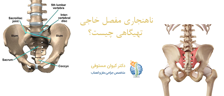 ناهنجاری مفصل خاجی‌ تهیگاهی چیست؟
